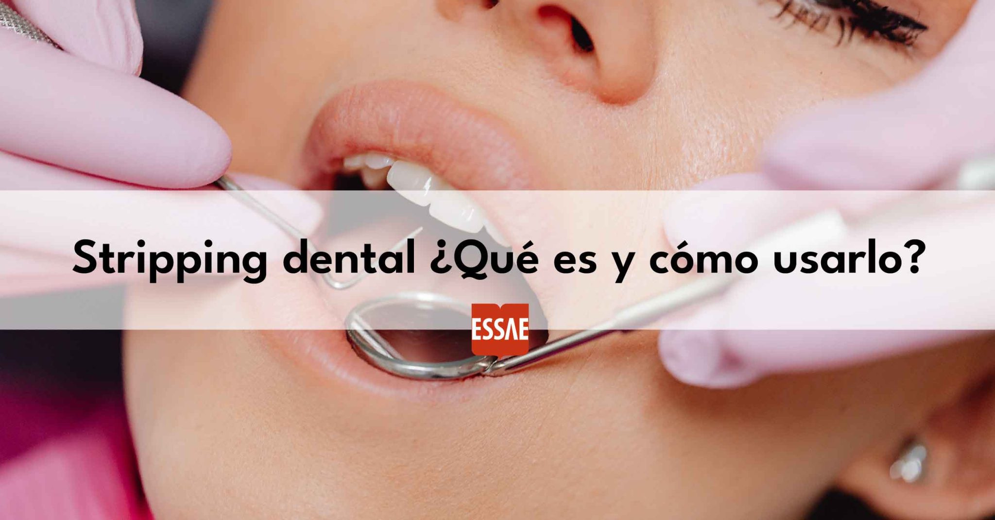 Qu Es El Stripping Dental En Ortodoncia Essae